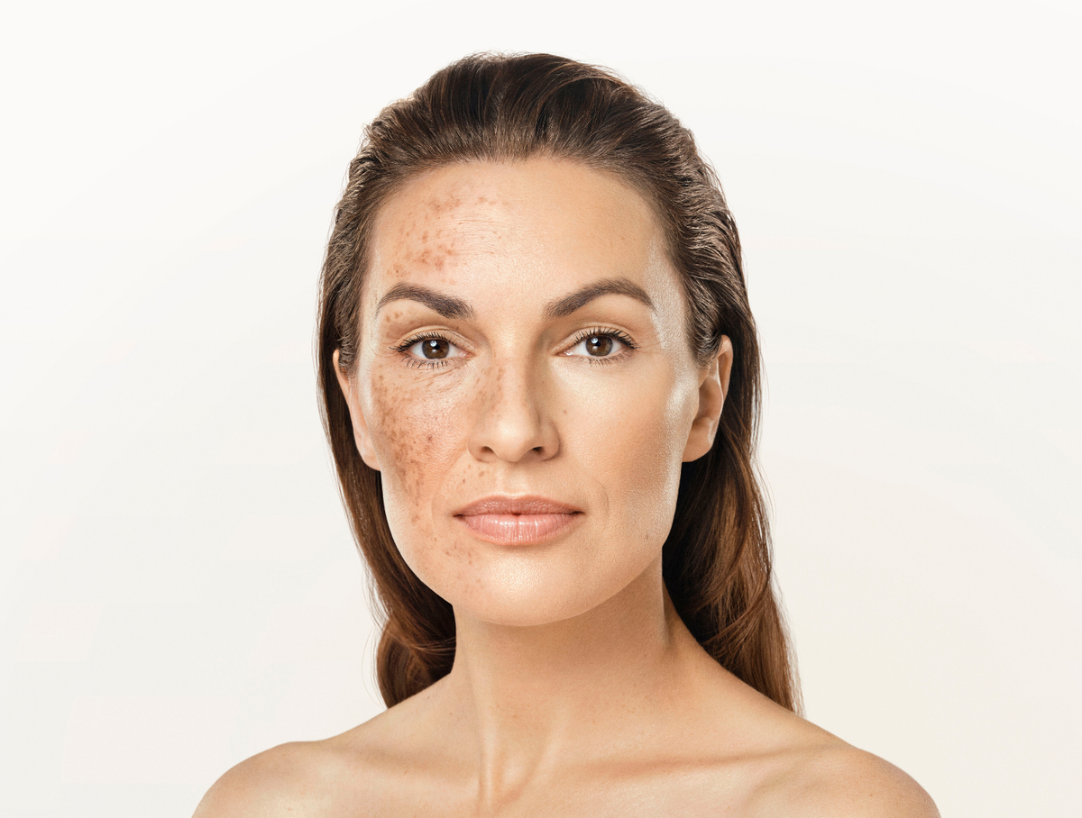 Nowość! Anti-Spot & Longevity Program